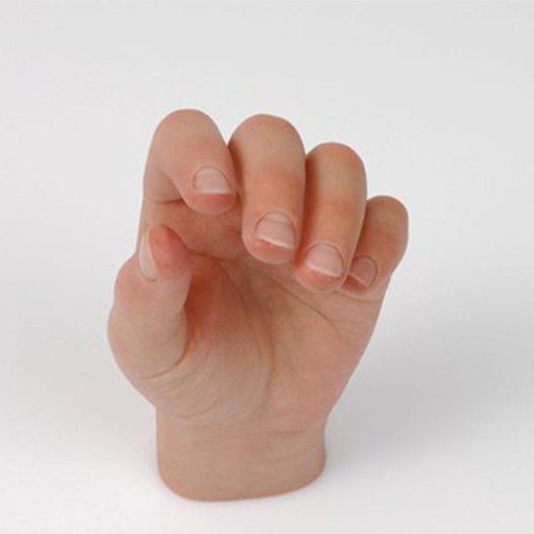 prothèse de main pour amputation partielle de la main ou des doigts, une  prothèse esthétique réaliste